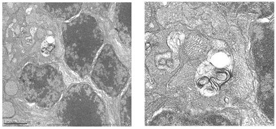 Acumulación de autofagosomas en retinas de ratones deficientes en Igf1