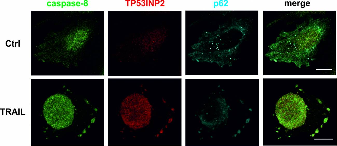 Diferentes localizaciones de las proteínas involucradas en apoptosis