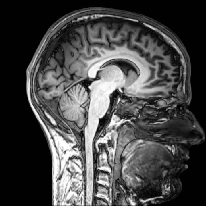 Imagen por resonancia magnética del cerebro. / Everyone's idle