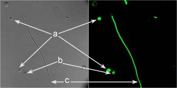 Tinción simultánea diferencial por BDP-MT de hongos (Fusarium) y amebas (Acanthamoeba castellanii). 