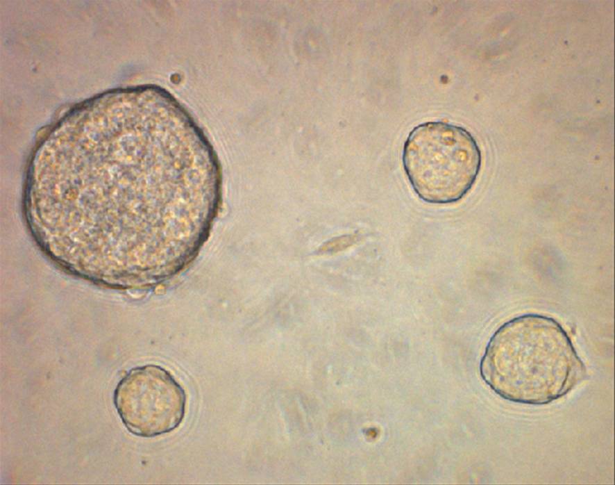 Células madre embrionarias de ratón. Imagen: CRG.