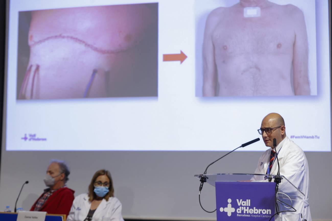 El jefe de Servicio de Cirugía Torácica y Trasplante Pulmonar de Vall d'Hebron, Albert Jauregui, durante la rueda de prensa