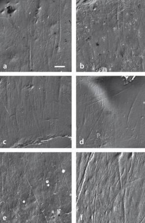 Imagen de microscopía electrónica de rastreo del patrón de microestriación bucal de los especímenes estudiados de A. anamensis(a-e) y de l'A. afarensis.(f)
