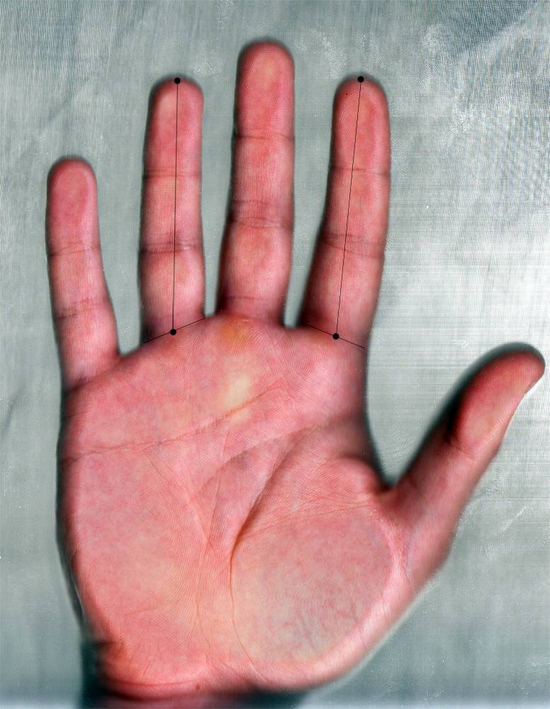 El ratio digital se obtiene al dividir la longitud del dedo índice entre la longitud del dedo anular de la misma mano. 
