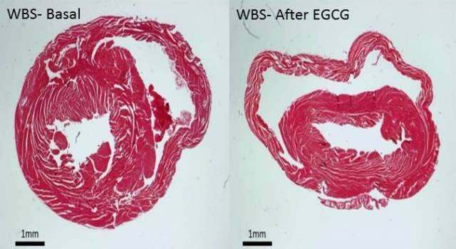 Secciones histológicas de la pared ventricular del corazón de modelos de síndrome de Williams-Beuren