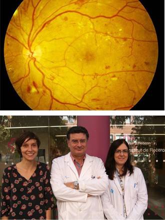 retina en estadios iniciales de la retinopatía diabética