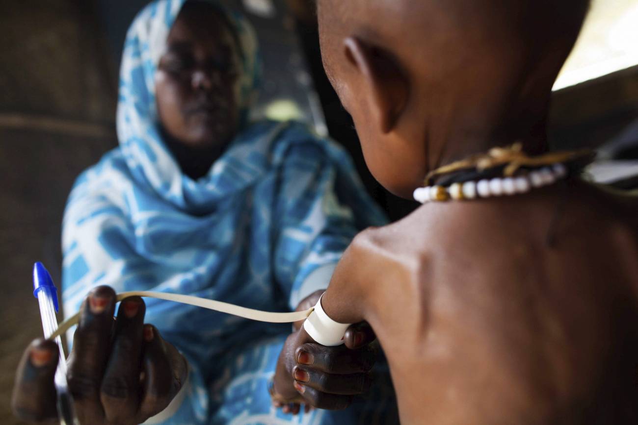 Una enfermera que mide el grosor del brazo de un niño con malnutrición. / ALBERT GONZALEZ FARRAN (UNAMID)