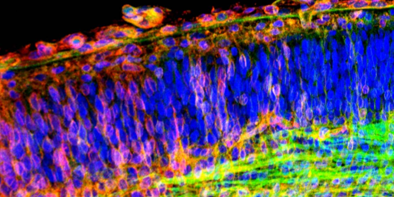 Imagen del cerebro captada mediante microscopia láser confocal donde se observan las neuronas (azul) y sus axones en crecimiento (rojo y verde). Autor: INc-UAB