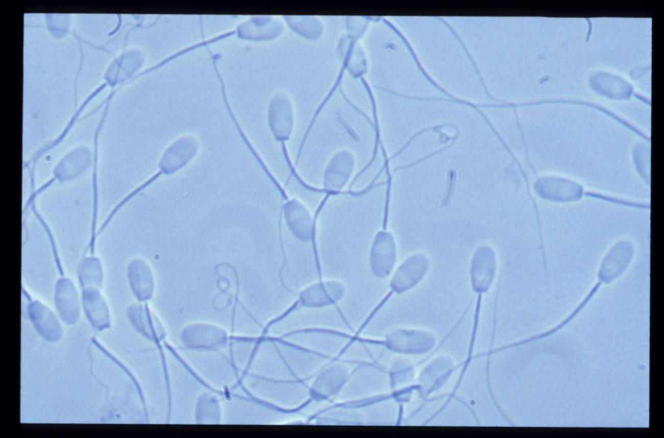 Una muestra al microscopio de espermatozoides empleados