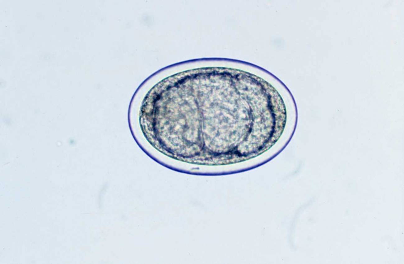 Dicrocoelium dentriticum es un parásito trematodo hepático que produce la dicroceliosis, una de las enfermedades parasitarias con mayor incidencia en ovejas