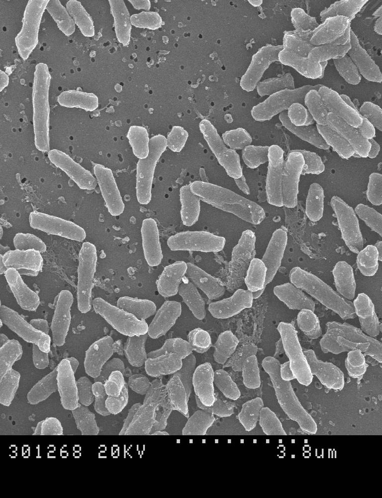Fotografía de Micobacterium brumae al microscopio