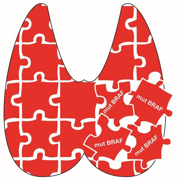 Esquema que representa una glándula tiroidea como un puzzle. La desorganización de estas piezas por la mutación del oncogén BRAF (mut) es determinante junto con la edad para el mal pronóstico