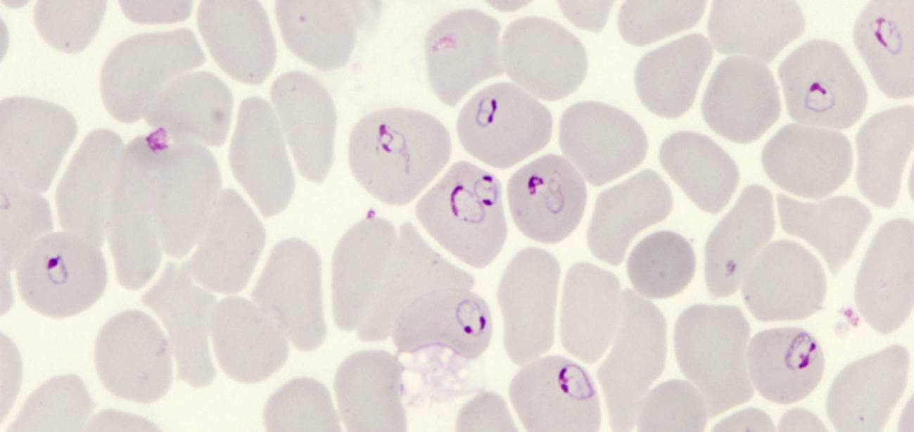 Anillos de 'Plasmodium falciparum' al microscopio