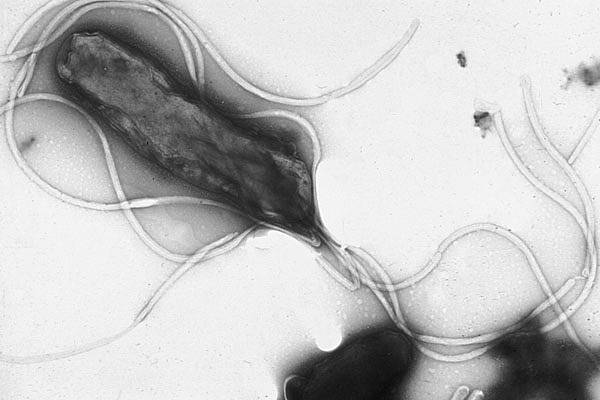 Helycobacter pylori. Imagen wikipedia
