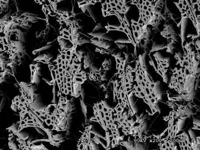 Imagen de microscopía electronic de un trozo de Madera degradado por el hongo Punctularia strigoso-zonata.
