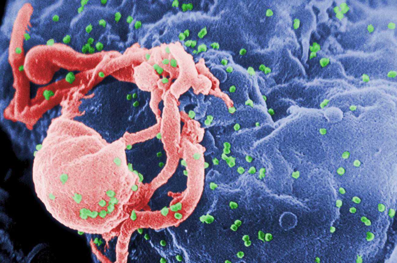 Viriones de VIH-1 ensamblándose en la superficie de un linfocito