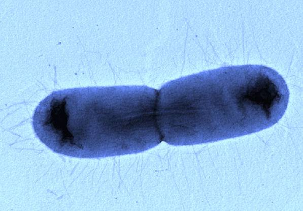 Imagen microscópica Escherichia coli.