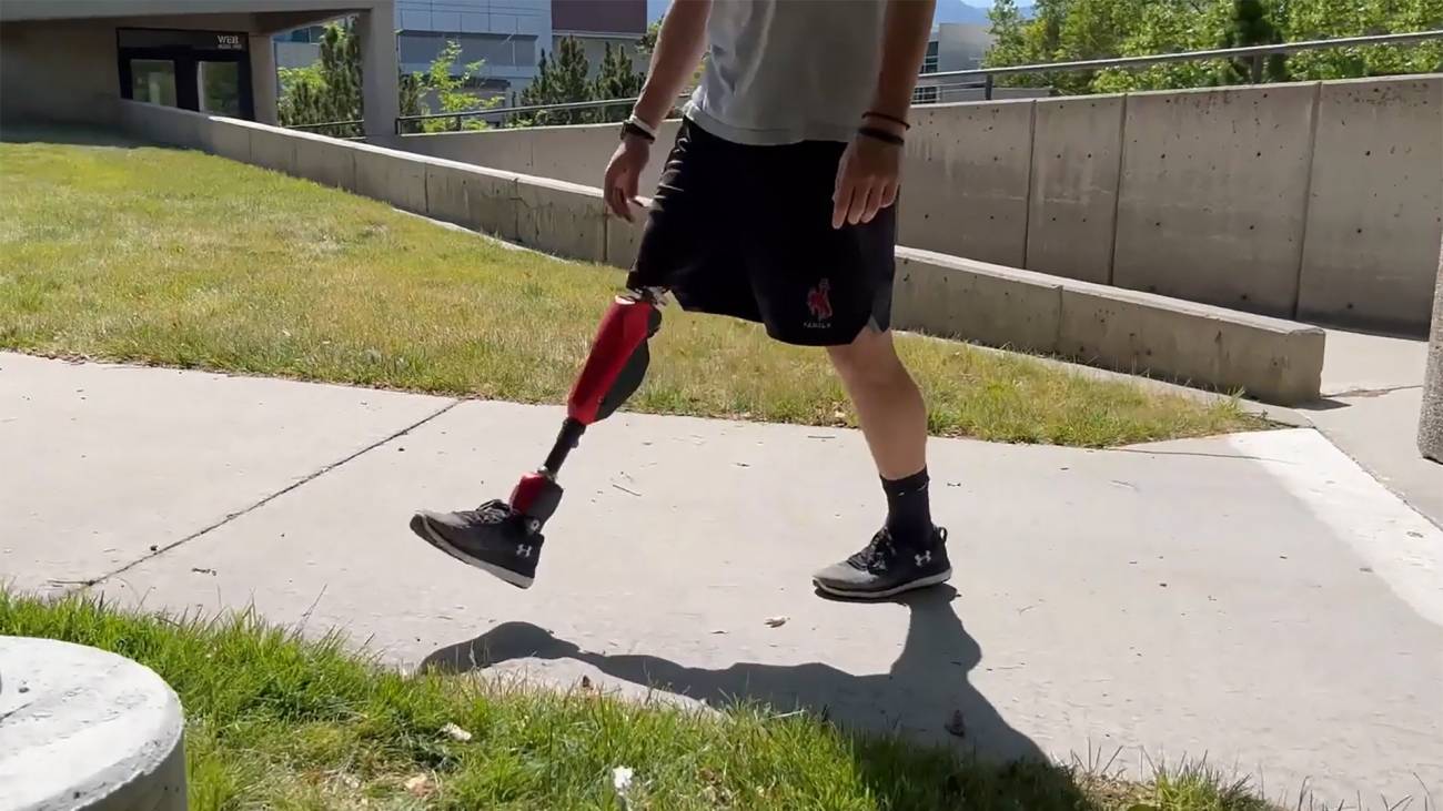 Prótesis robótica de pierna