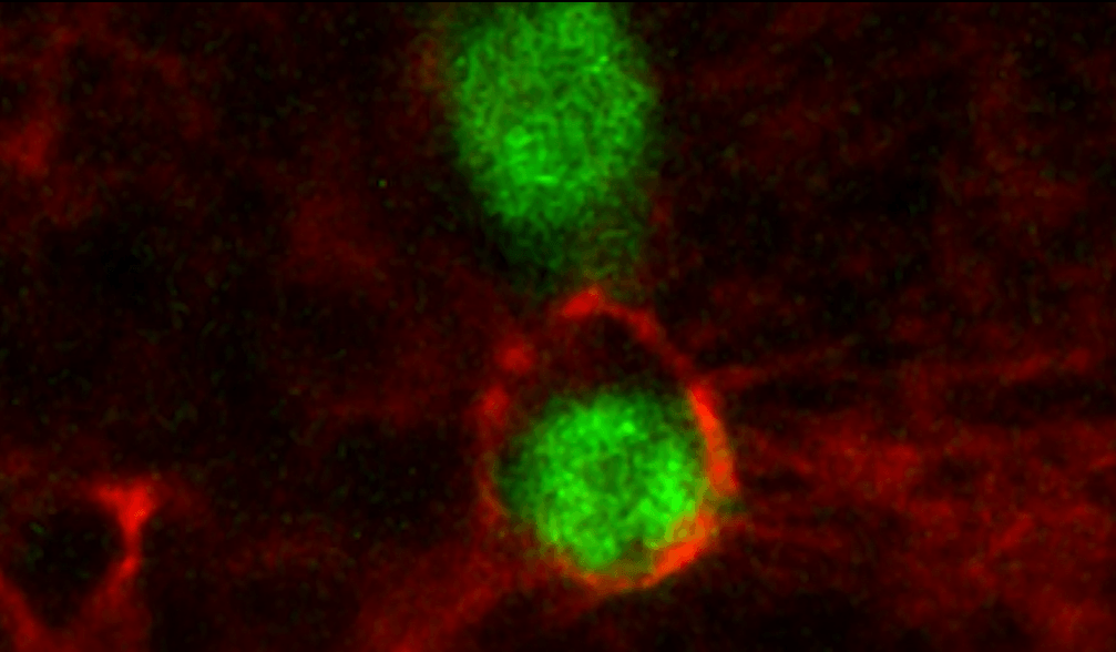 En la primera mitad del vídeo, se ven células tumorales (en verde) que proliferan activamente en una matriz de colágeno I. En la segunda mitad, se observa lo que ocurre cuando las células cancerosas están en colágeno III: estas dejan de dividirse y remodelan la matriz a su alrededor