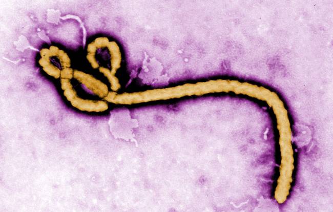 Virus del ébola. / Efe