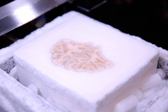 El cerebro de H.M. criogenizado para su estudio. / Universidad de San Diego