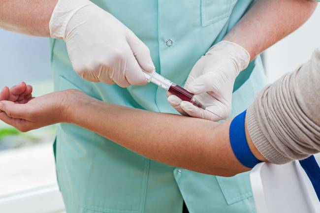 Un solo test sanguíneo podría revelar si una persona sana tiene alguna probabilidad de morir de neumonía. / Fotolia