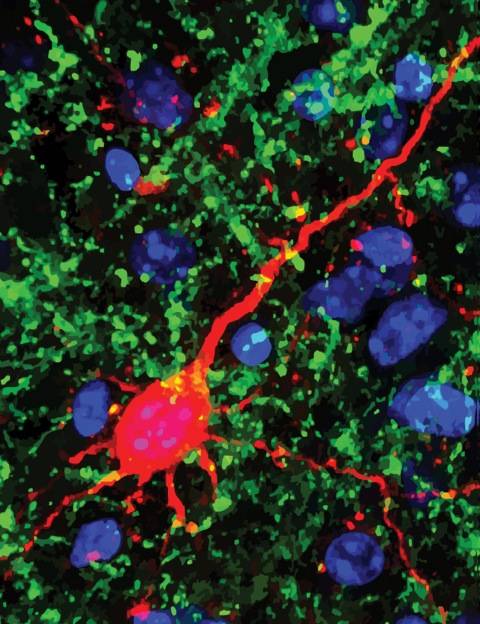 En color verde, las nuevas conexiones neuronales del ratón tras una ceguera simulada. / Emily Petrus 