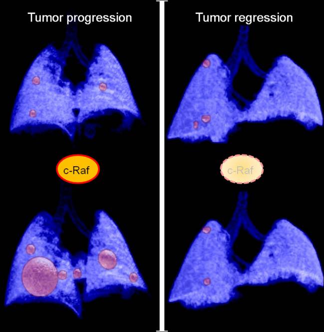 La eliminación de c-Raf induce la regresión de los tumores de pulmón avanzados en modelos de ratón