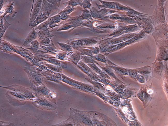Imágenes microscópicas de células del músculo