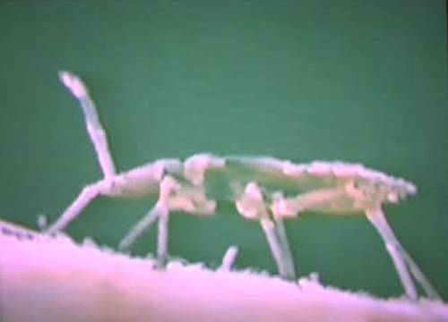 La enfermedad de Chagas está provocada por un parásito llamado Trypanosoma cruzi