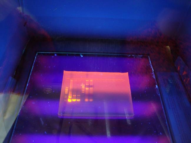 Electroforesis de ADN observada bajo luz ultravioleta.