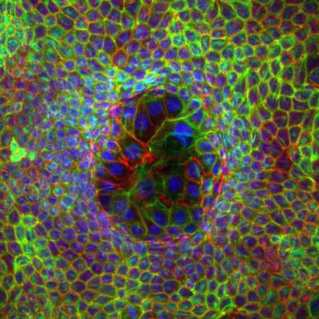 Células superdeformadas rodeadas por otras mínimamente deformadas