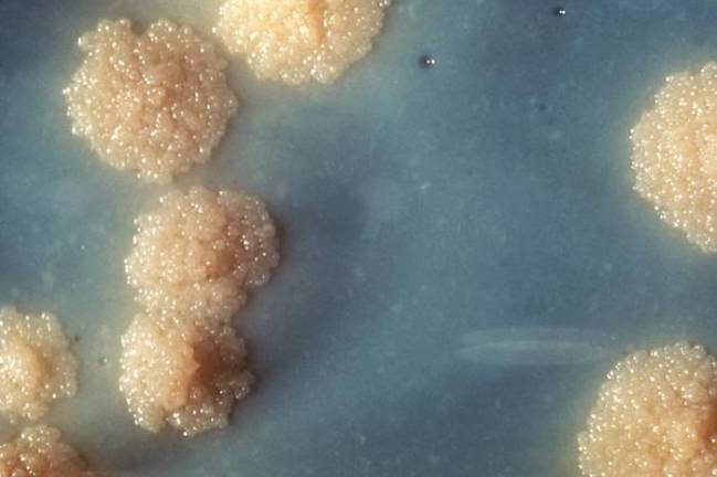 Colonización bacteriana de Mycobacterium tuberculosis. / Wikipedia