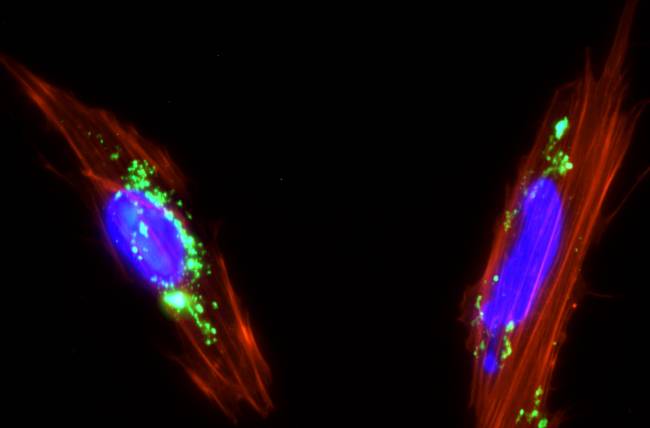 Células mesenquimales de placenta con nanopartículas de sílice mesoporosa (color verde) internalizadas en su citoplasma. / Juan Luis Paris.