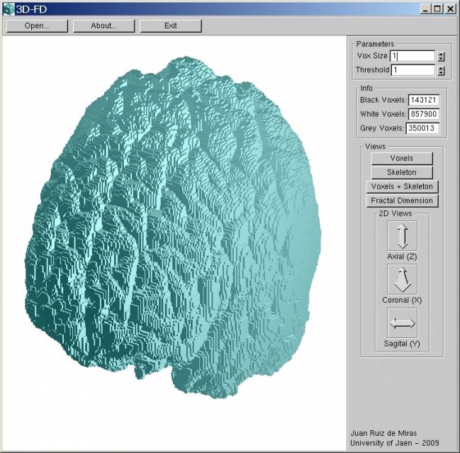 Vista del cerebro en 3D con la nueva aplicación