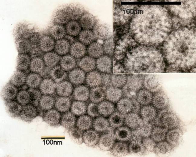 Imagen del rotavirus