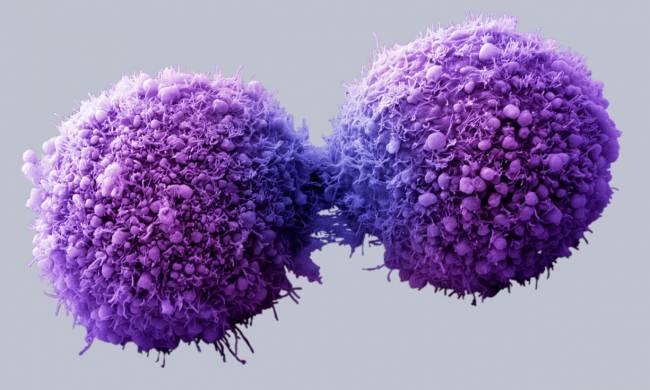 Células de páncreas cancerosas completando la división celular - Getty Images/Visuals Unlimited