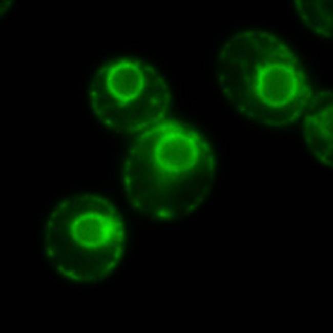 Retículo endoplásmico en células de la levadura Saccharomyces cerevisiae marcado con una proteína fluorescente