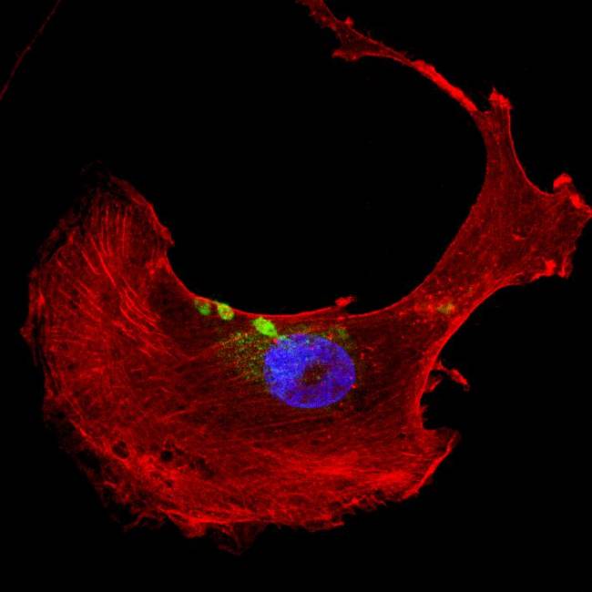 Figura que representa una célula cardíaca con acúmulos de filamina C mutante (en color verde).
