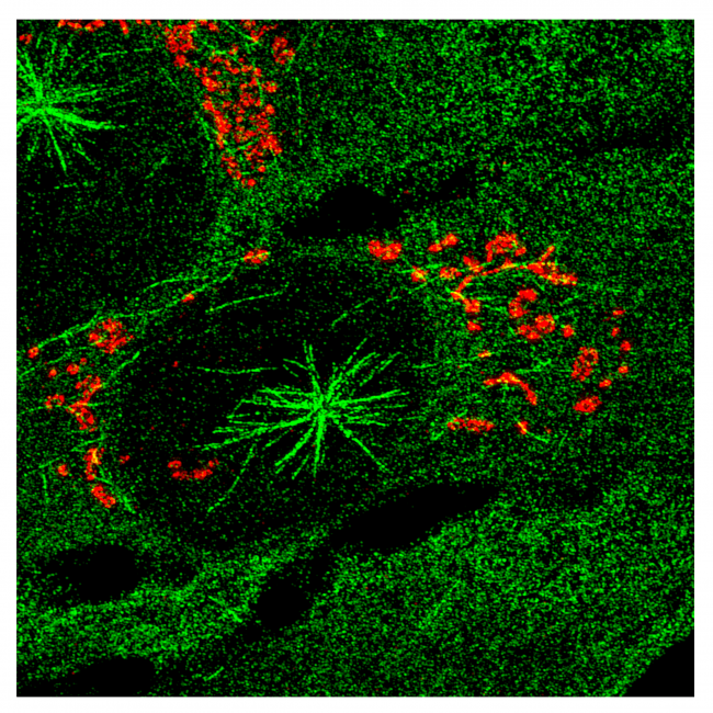 células humanas con microtúbulos