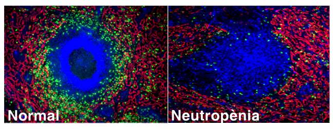 Imágenes de linfocitos B (en azul) rodeados de neutrófilos (en verde) y de células endoteliales (en rojo) del bazo. La imagen izquierda corresponde a un bazo normal y la derecha a la de un paciente con neutropenia, donde se observa que la presencia de neutrófilos es mucho menor.