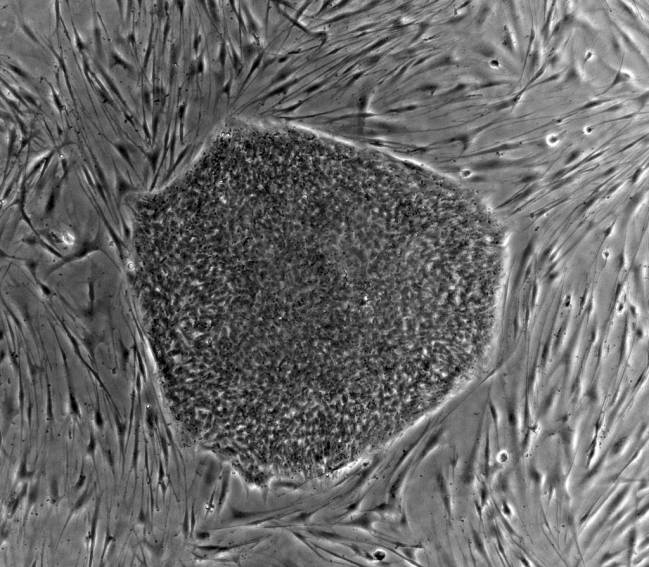célula madre