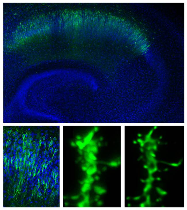 Panel superior e inferior izquierdo: expresión de receptores de neurotransmisor marcados fluorescentemente (verde) en secciones de hipocampo, la zona del cerebro implicada en la formación de memorias. Panel inferior, centro y derecha: detalle morfológico de las conexiones sinápticas entre neuronas. La inserción de nuevos receptores de neurotransmisor en estas conexiones es un mecanismo fundamental para el aprendizaje y la memoria.