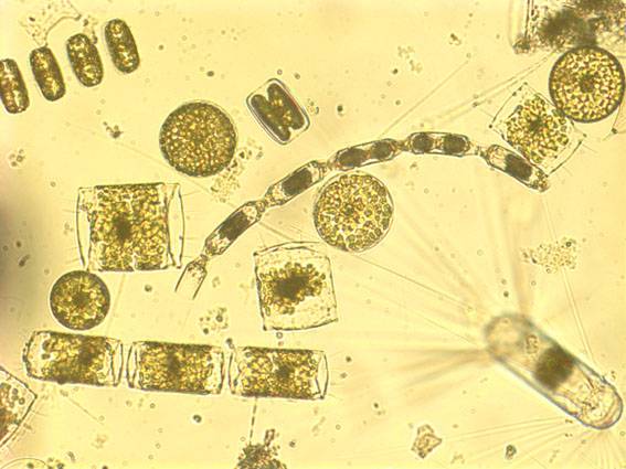 Diatomeas, organismo marinos de tamaño microscópico. Foto: Fundación BBVA.