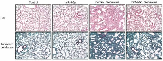 miR-9-5p previene el desarrollo de la fibrosis pulmonar idiopática