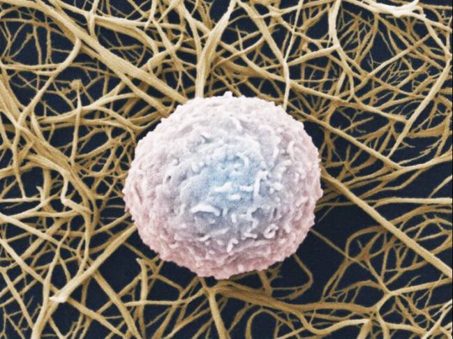 Imagen microscópica de un glóbulo blanco.