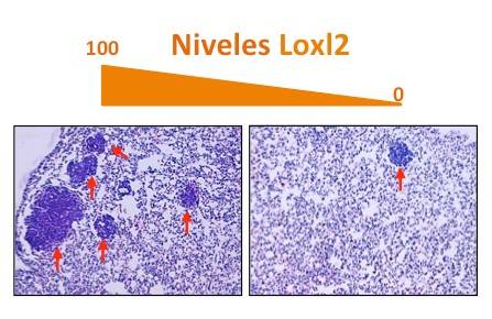 Imágenes microscópicas de cortes histológicos de pulmones con metástasis. Izquierda: metástasis originadas a partir de tumores con niveles normales de Loxl2. Derecha: metástasis producidas a partir de tumores en los que se ha eliminado Loxl2.