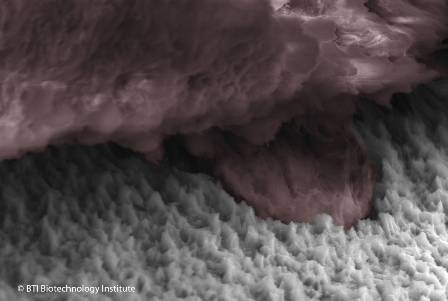 Imagen de microscopía electrónica de barrido de un implante dental extraído