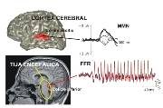 El tallo encefálico también tiene la capacidad de codificar probabilísticamente la estimulación auditiva. (imagen: C.Escera et al.)