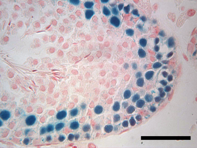sección transversal de un testículo de ratón infértil